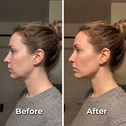 Lunovi® Lymphatic Face Brush